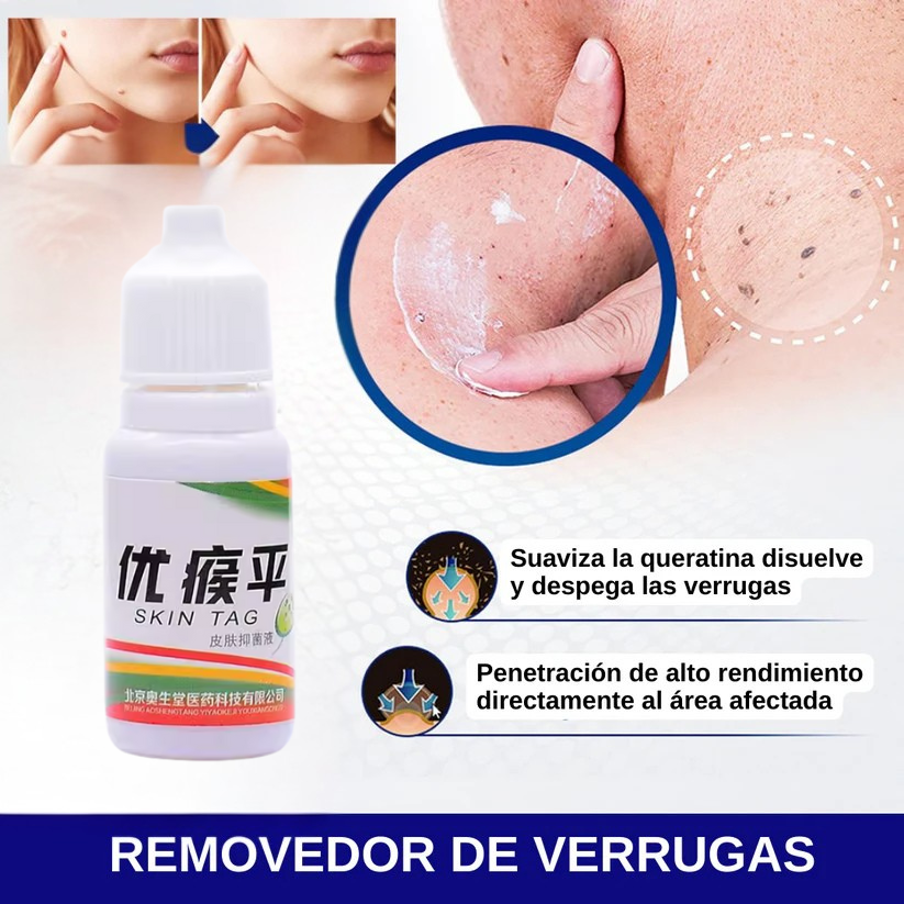 SKIN TAG GOTA ™  - Eliminador de  Lunares y Verrugas
