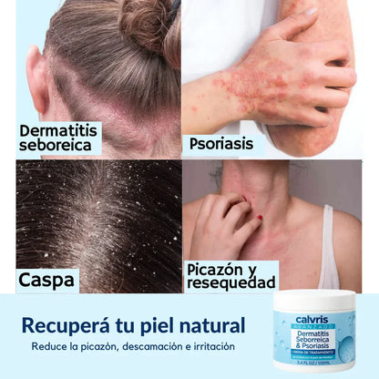 Calvris® – Alivio inmediato y calma profunda para tu piel