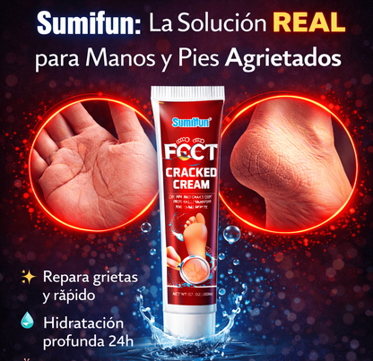 Sumifun: La Solución REAL para Manos y Pies Agrietados
