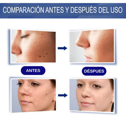 SKIN TAG GOTA ™  - Eliminador de  Lunares y Verrugas